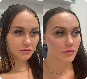 Client